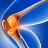 READ THIS - How to deal with Rheumatoid Arthritis